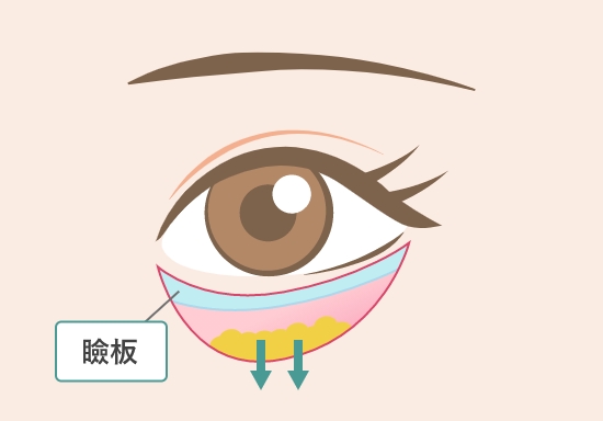 脂肪を下方向へずらします