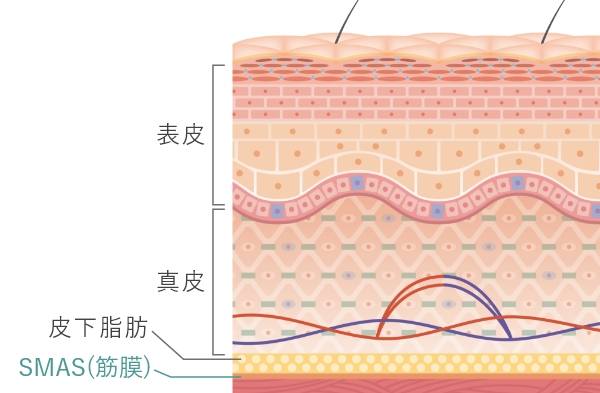 糸リフトの確かな技術力